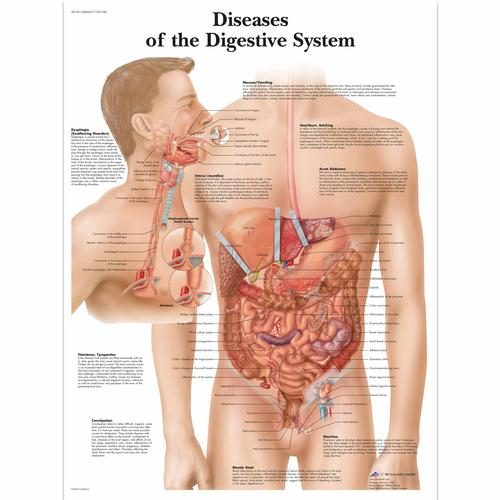 Digestive System Diseases Chart